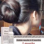 Havelyn Hair Food Oil For Healthy Long & Strong Hair | Hair fall